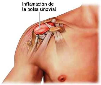 Images